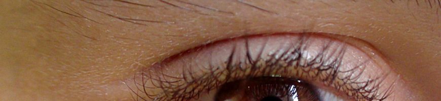 blefaroplastia mal hecha